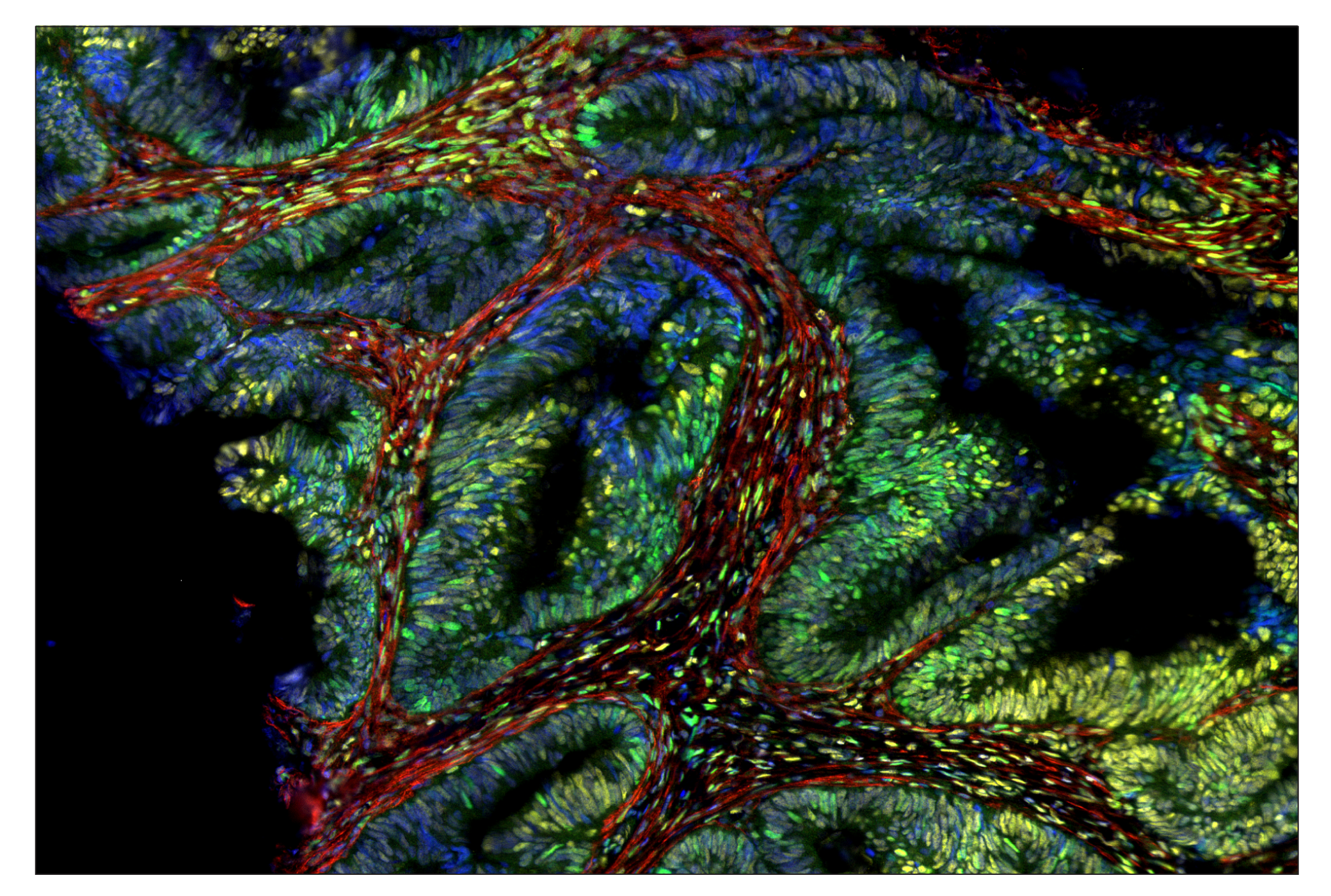 Immunohistochemistry Image 8: Phospho-CREB (Ser133) (87G3) & CO-0125-488 SignalStar™ Oligo-Antibody Pair