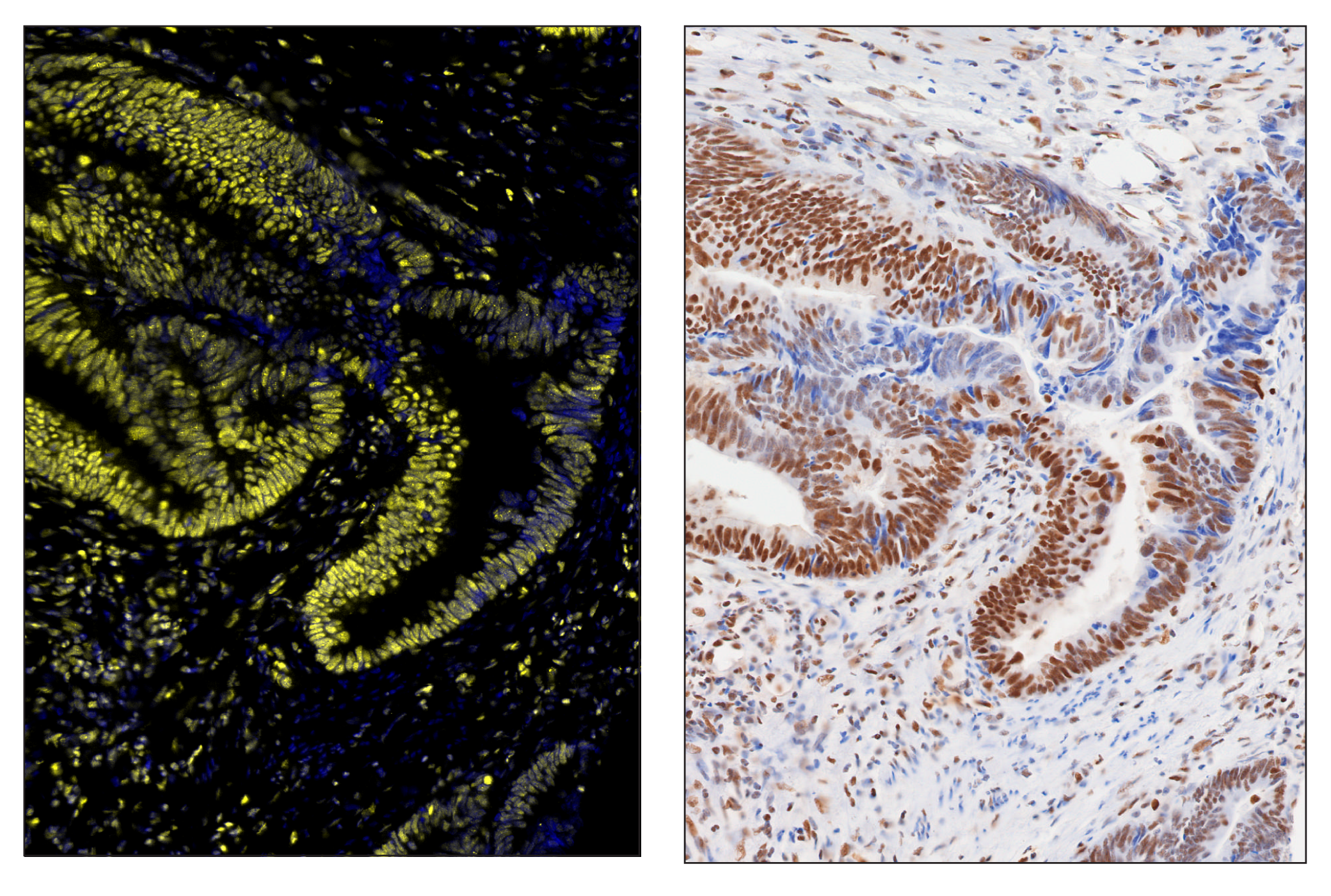 Immunohistochemistry Image 6: Phospho-CREB (Ser133) (87G3) & CO-0125-488 SignalStar™ Oligo-Antibody Pair