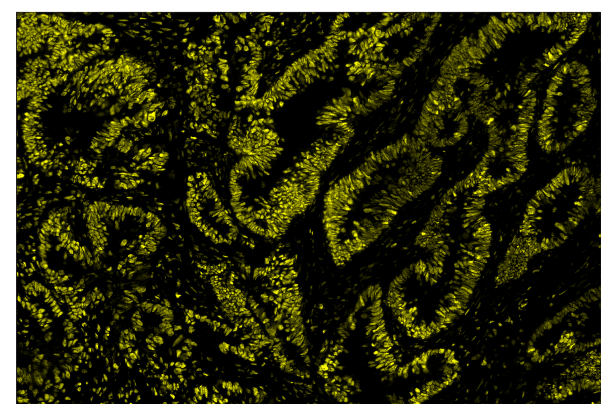 Immunohistochemistry Image 3: Phospho-CREB (Ser133) (87G3) & CO-0125-488 SignalStar™ Oligo-Antibody Pair