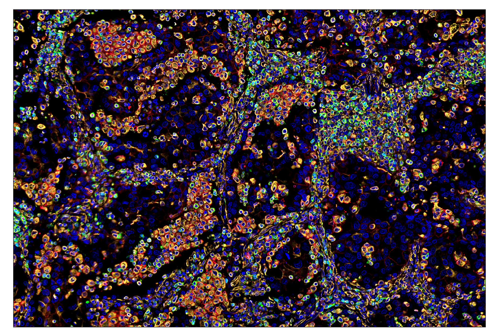 Immunohistochemistry Image 7: TIM-3 (D5D5R™) & CO-0010-647 SignalStar™ Oligo-Antibody Pair