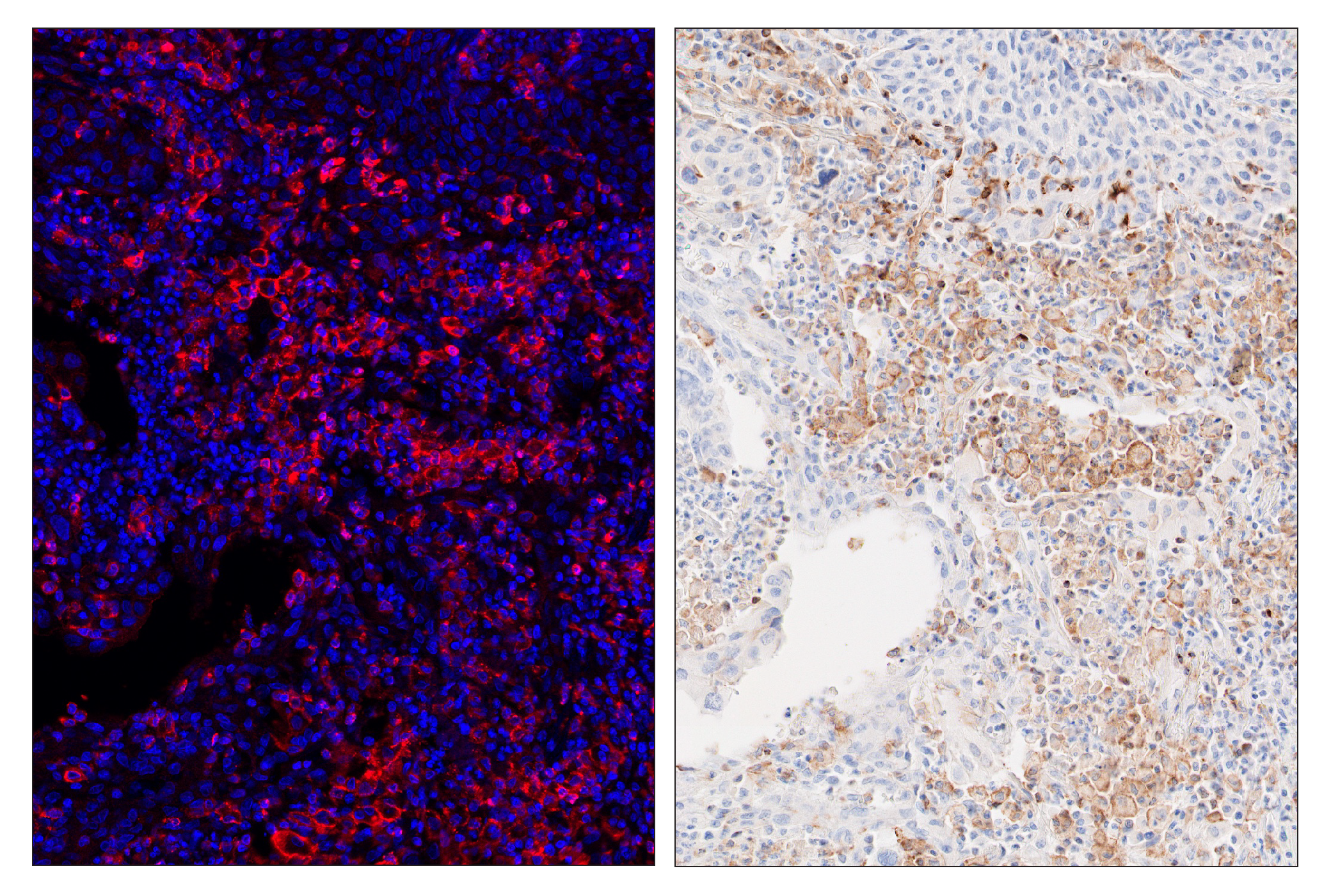 Immunohistochemistry Image 6: TIM-3 (D5D5R™) & CO-0010-750 SignalStar™ Oligo-Antibody Pair