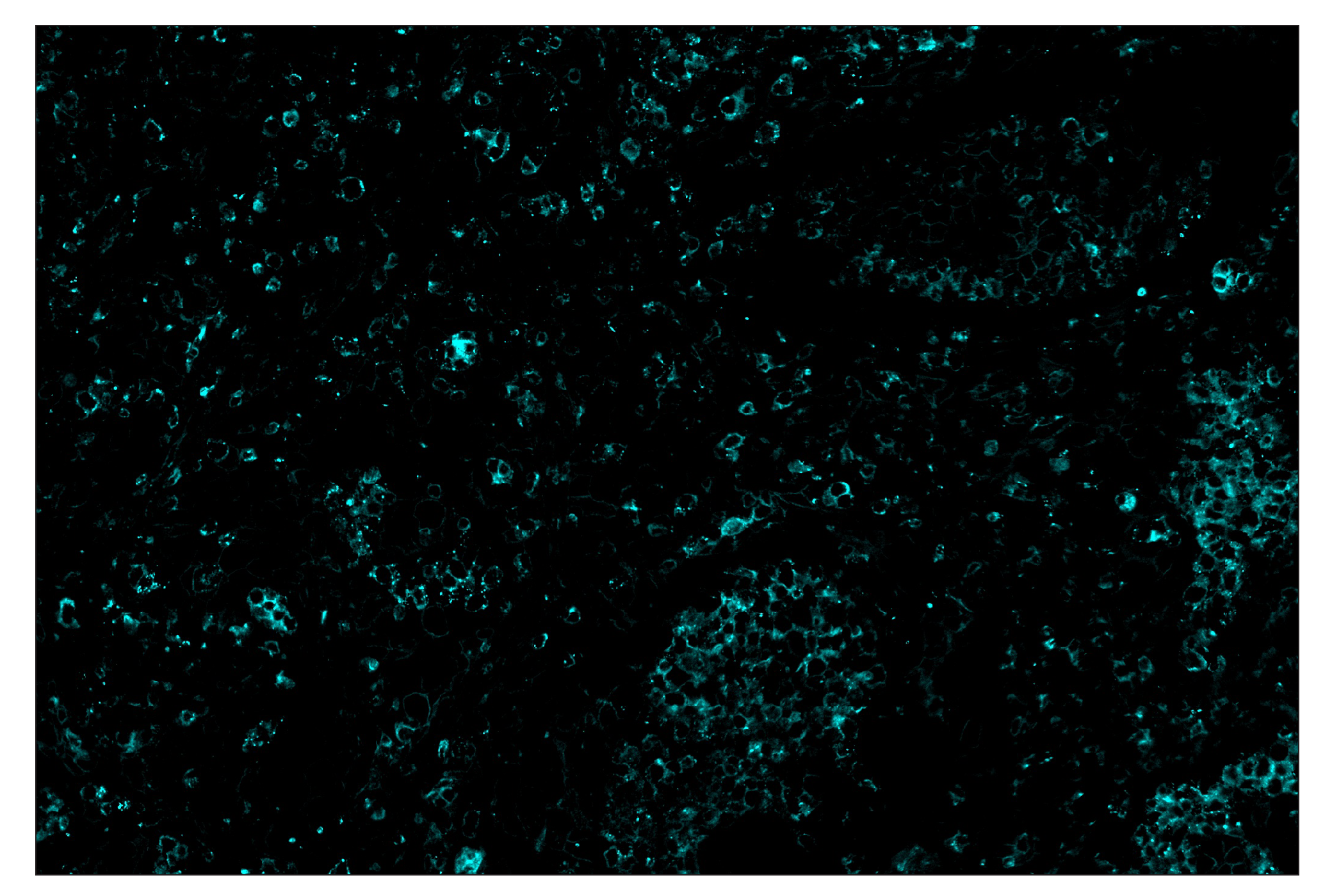 Immunohistochemistry Image 5: TIM-3 (D5D5R™) & CO-0010-750 SignalStar™ Oligo-Antibody Pair