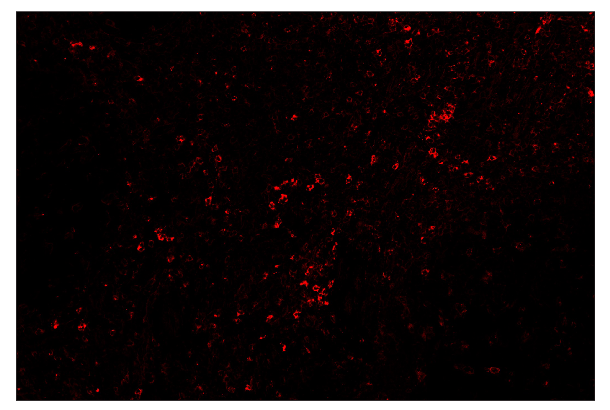 Immunohistochemistry Image 4: TIM-3 (D5D5R™) & CO-00010-488 SignalStar™ Oligo-Antibody Pair