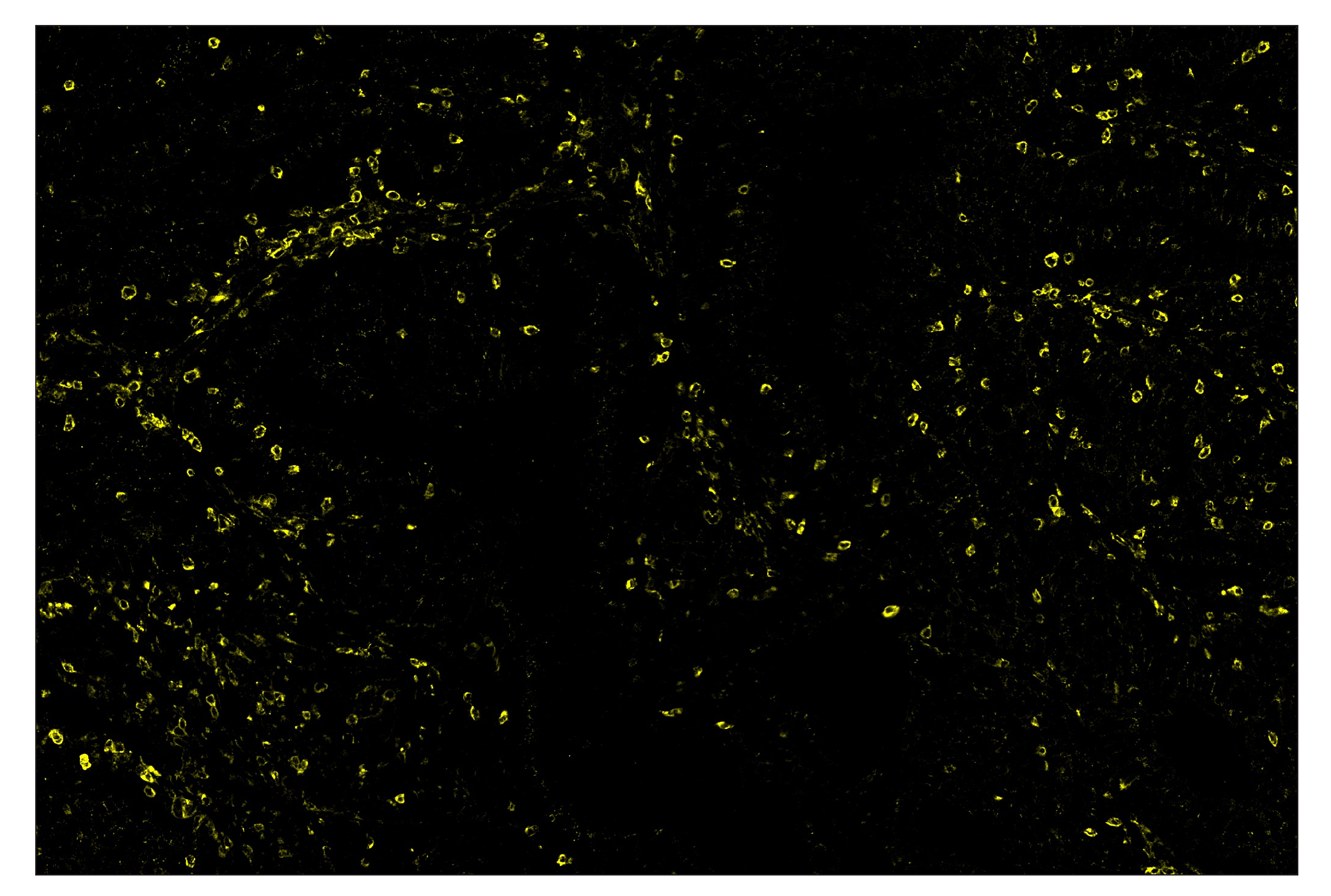 Immunohistochemistry Image 3: TIM-3 (D5D5R™) & CO-00010-488 SignalStar™ Oligo-Antibody Pair