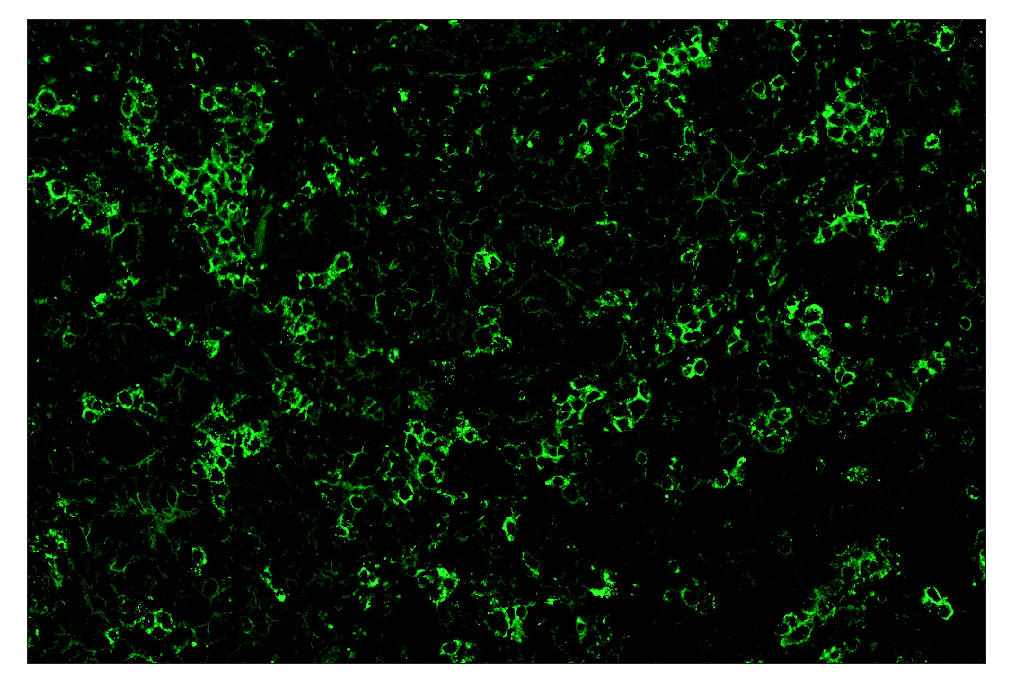Immunohistochemistry Image 2: TIM-3 (D5D5R™) & CO-00010-488 SignalStar™ Oligo-Antibody Pair