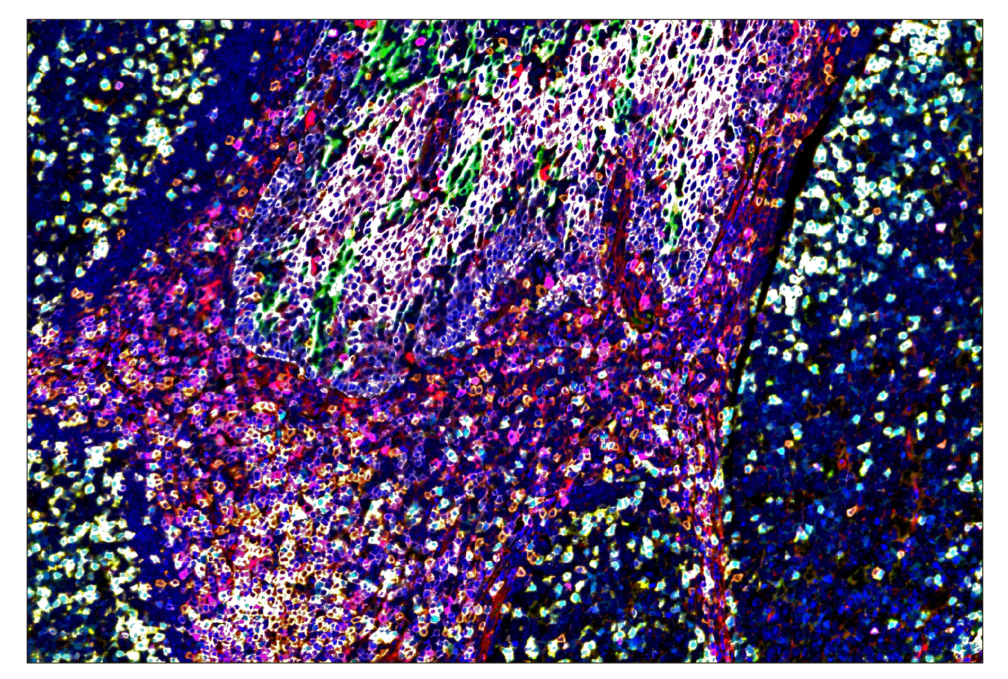 Immunohistochemistry Image 1: TIM-3 (D5D5R™) & CO-0010-647 SignalStar™ Oligo-Antibody Pair
