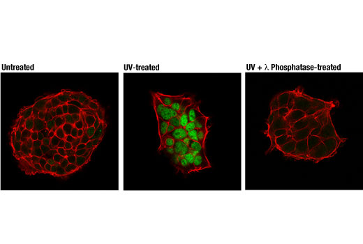 Immunofluorescence Image 1: Phospho-SMC1 (Ser957) (D7S8Y) Rabbit mAb