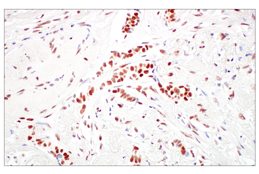Immunohistochemistry Image 8: Rad50 (E4J5R) Rabbit mAb (BSA and Azide Free)