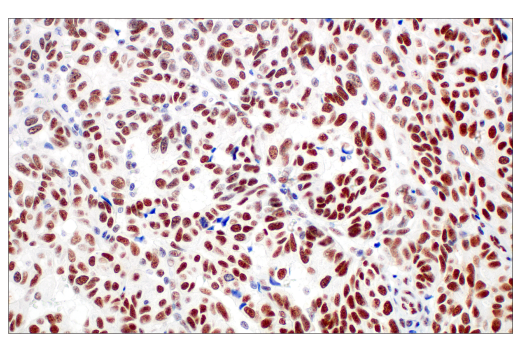 Immunohistochemistry Image 1: Rad50 (E4J5R) Rabbit mAb (BSA and Azide Free)
