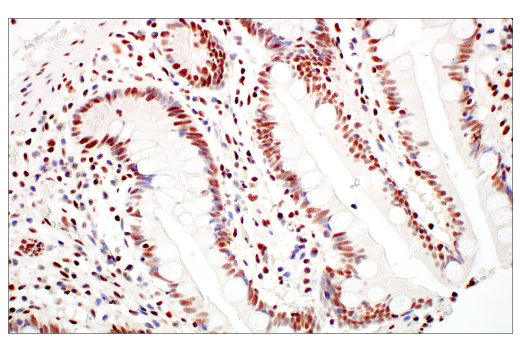 Immunohistochemistry Image 9: Rad50 (E4J5R) Rabbit mAb (BSA and Azide Free)