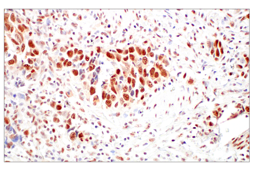Immunohistochemistry Image 3: Rad50 (E4J5R) Rabbit mAb (BSA and Azide Free)