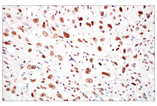 Immunohistochemistry Image 5: Rad50 (E4J5R) Rabbit mAb (BSA and Azide Free)