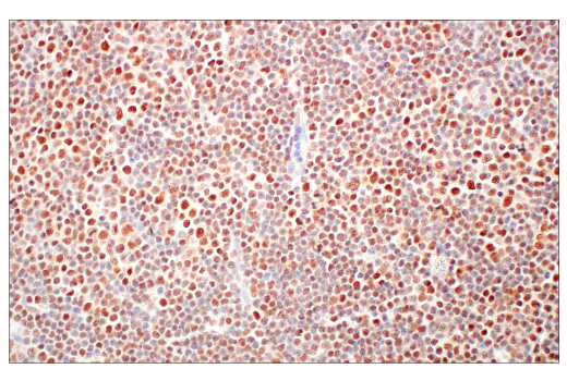 Immunohistochemistry Image 7: Rad50 (E4J5R) Rabbit mAb (BSA and Azide Free)