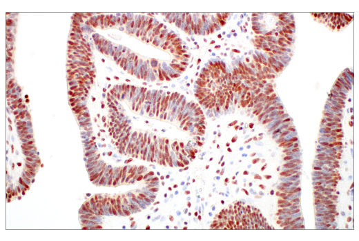 Immunohistochemistry Image 4: Rad50 (E4J5R) Rabbit mAb (BSA and Azide Free)