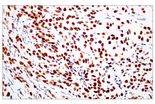 Immunohistochemistry Image 2: Rad50 (E4J5R) Rabbit mAb (BSA and Azide Free)
