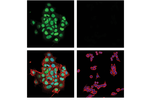 Immunofluorescence Image 1: MGMT (E6M7V) Rabbit mAb