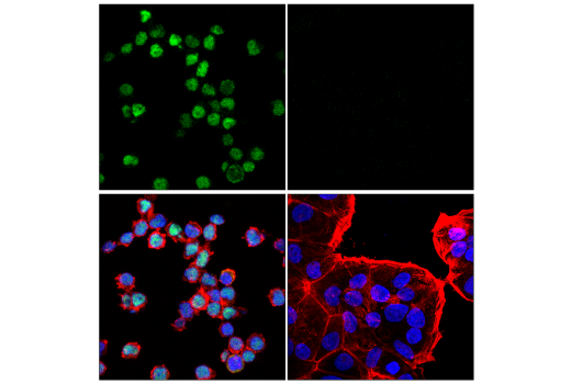 Immunofluorescence Image 1: Tox (E5J8A) Rabbit mAb