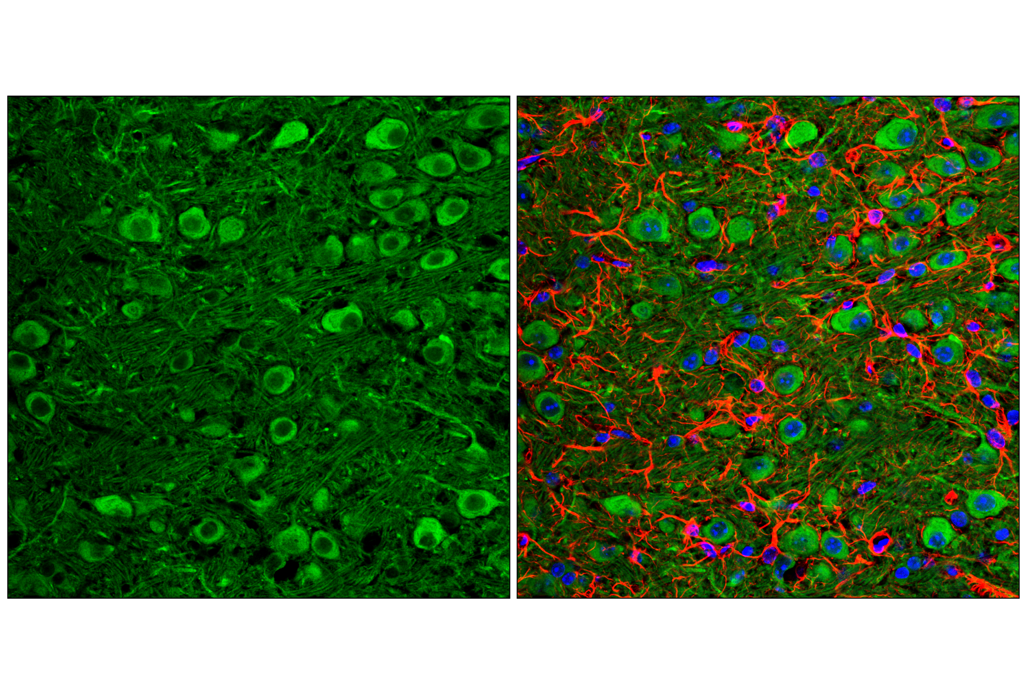 Immunofluorescence Image 2: LC3A/B (D3U4C) XP® Rabbit mAb (BSA and Azide Free)