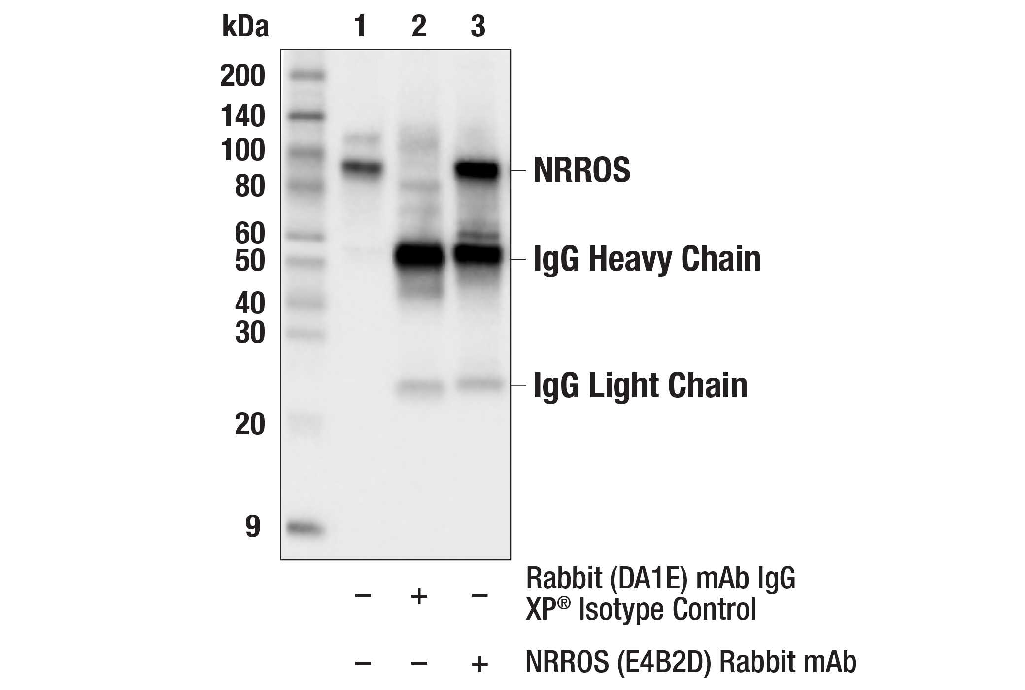 Immunoprecipitation Image 1: NRROS (E4B2D) Rabbit mAb