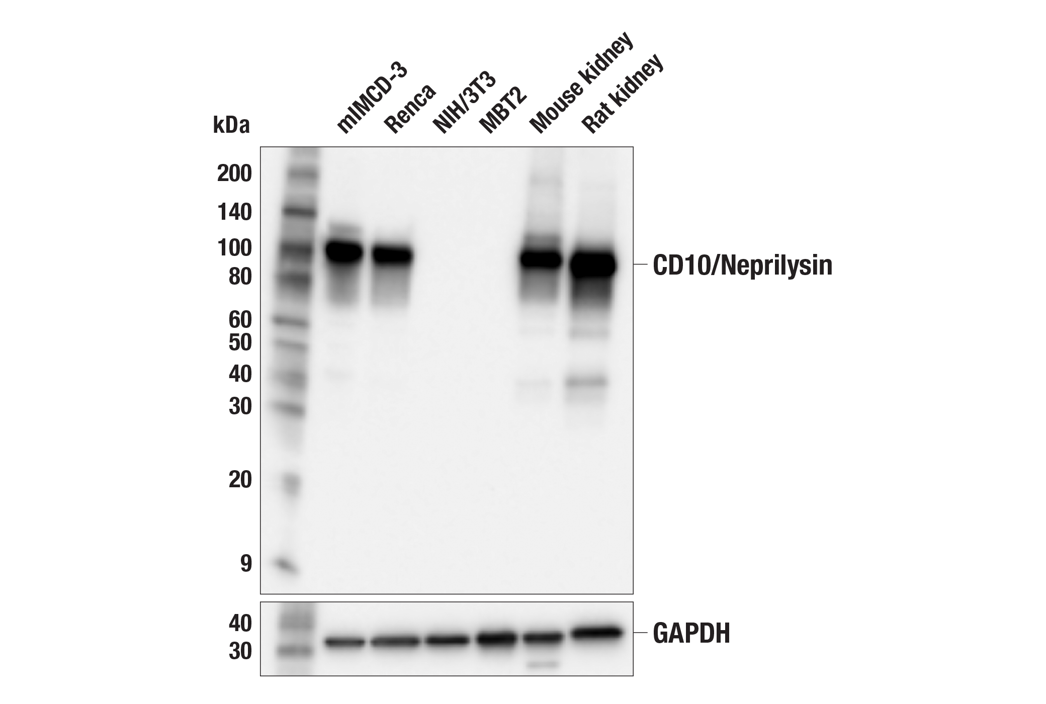 Western Blotting Image 1: CD10/Neprilysin (F4P6H) Rabbit mAb