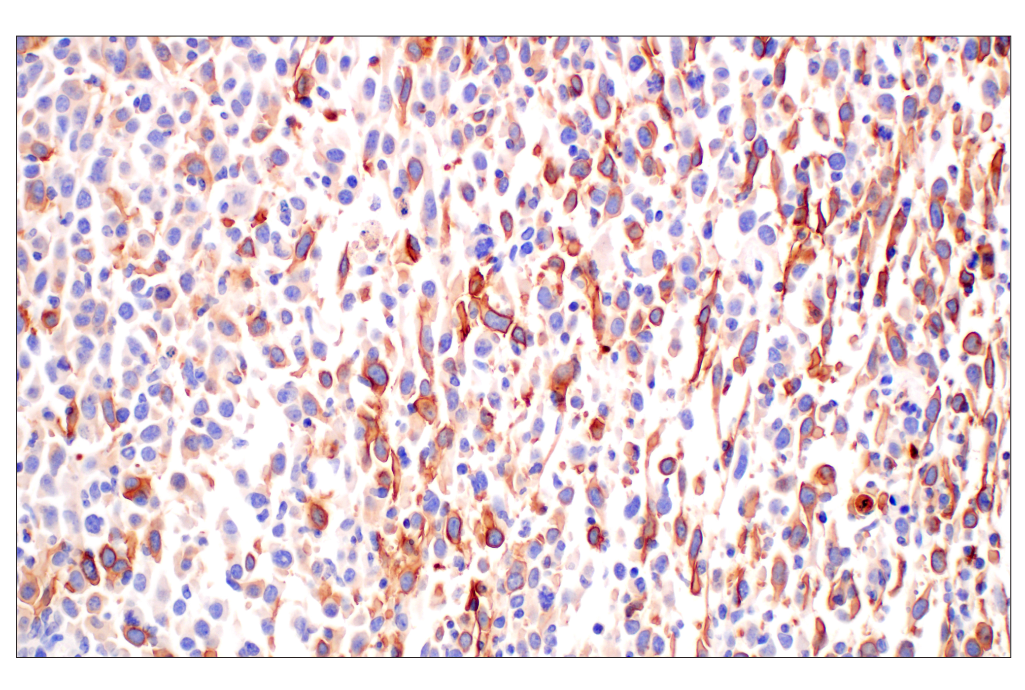 Immunohistochemistry Image 2: CD10/Neprilysin (F4P6H) Rabbit mAb