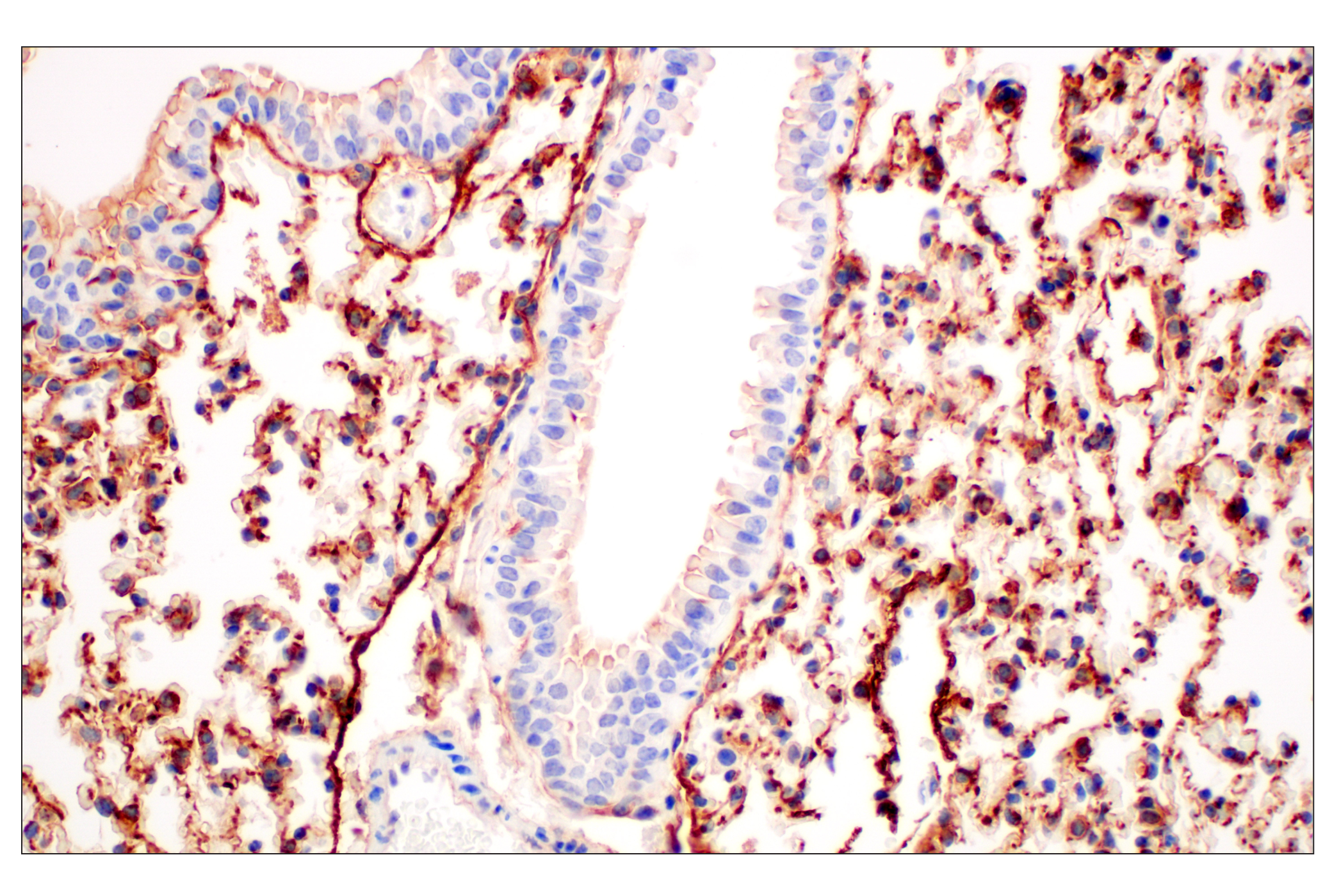 Immunohistochemistry Image 3: CD10/Neprilysin (F4P6H) Rabbit mAb