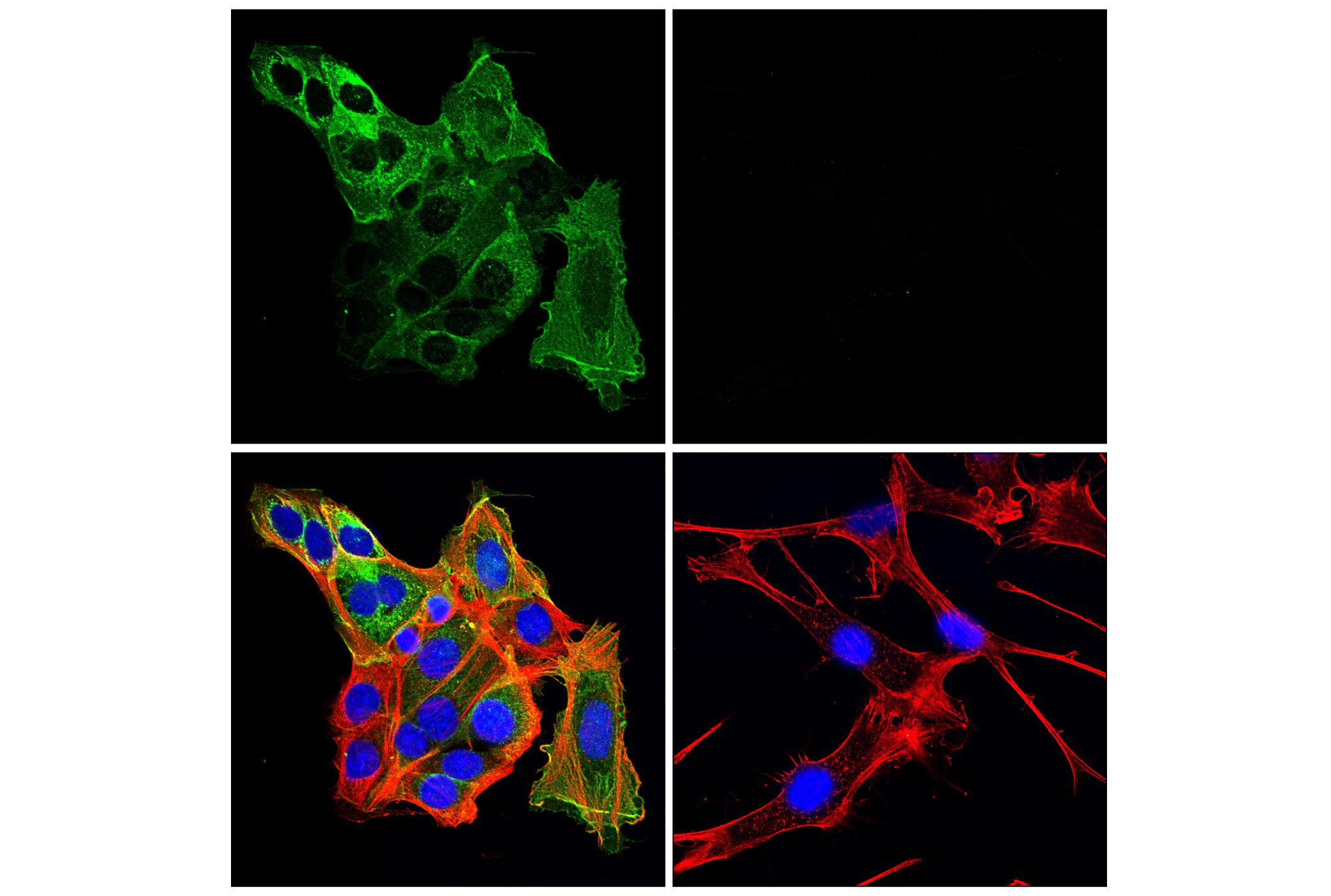 Immunofluorescence Image 3: CD10/Neprilysin (F4P6H) Rabbit mAb
