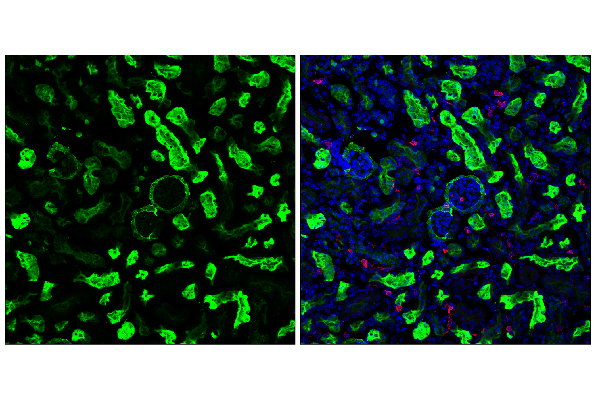 Immunofluorescence Image 1: CD10/Neprilysin (F4P6H) Rabbit mAb