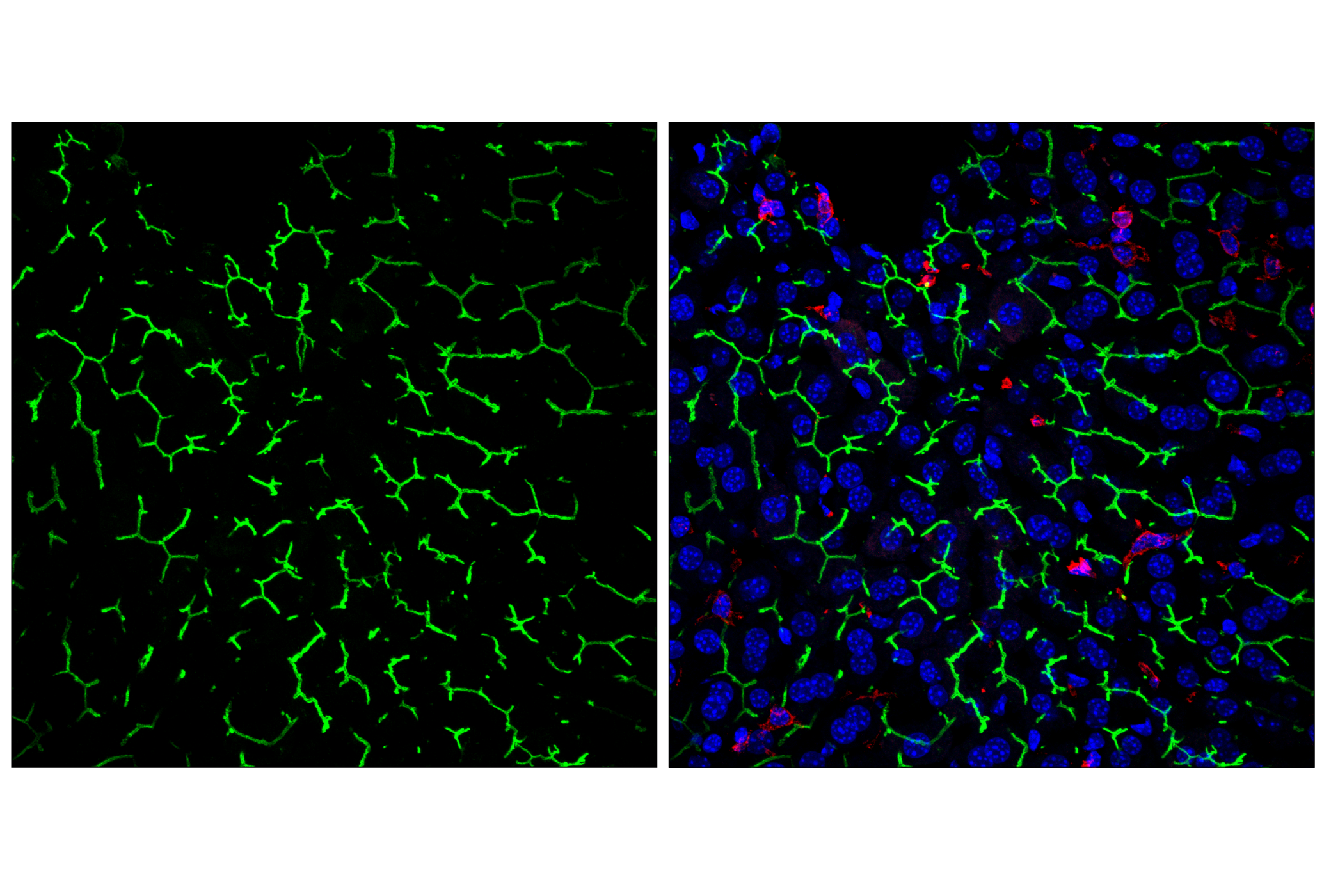 Immunofluorescence Image 2: CD10/Neprilysin (F4P6H) Rabbit mAb