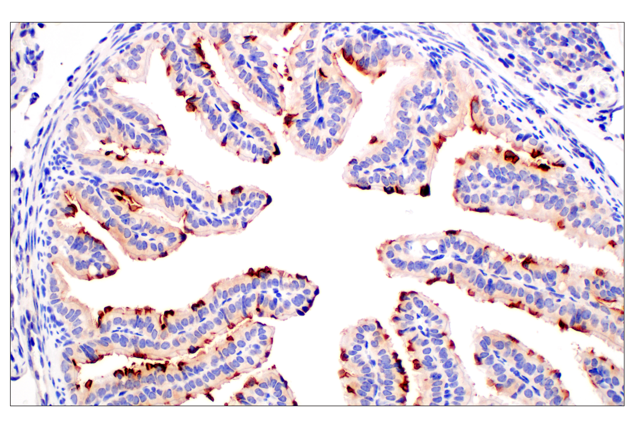 Immunohistochemistry Image 6: CD10/Neprilysin (F4P6H) Rabbit mAb