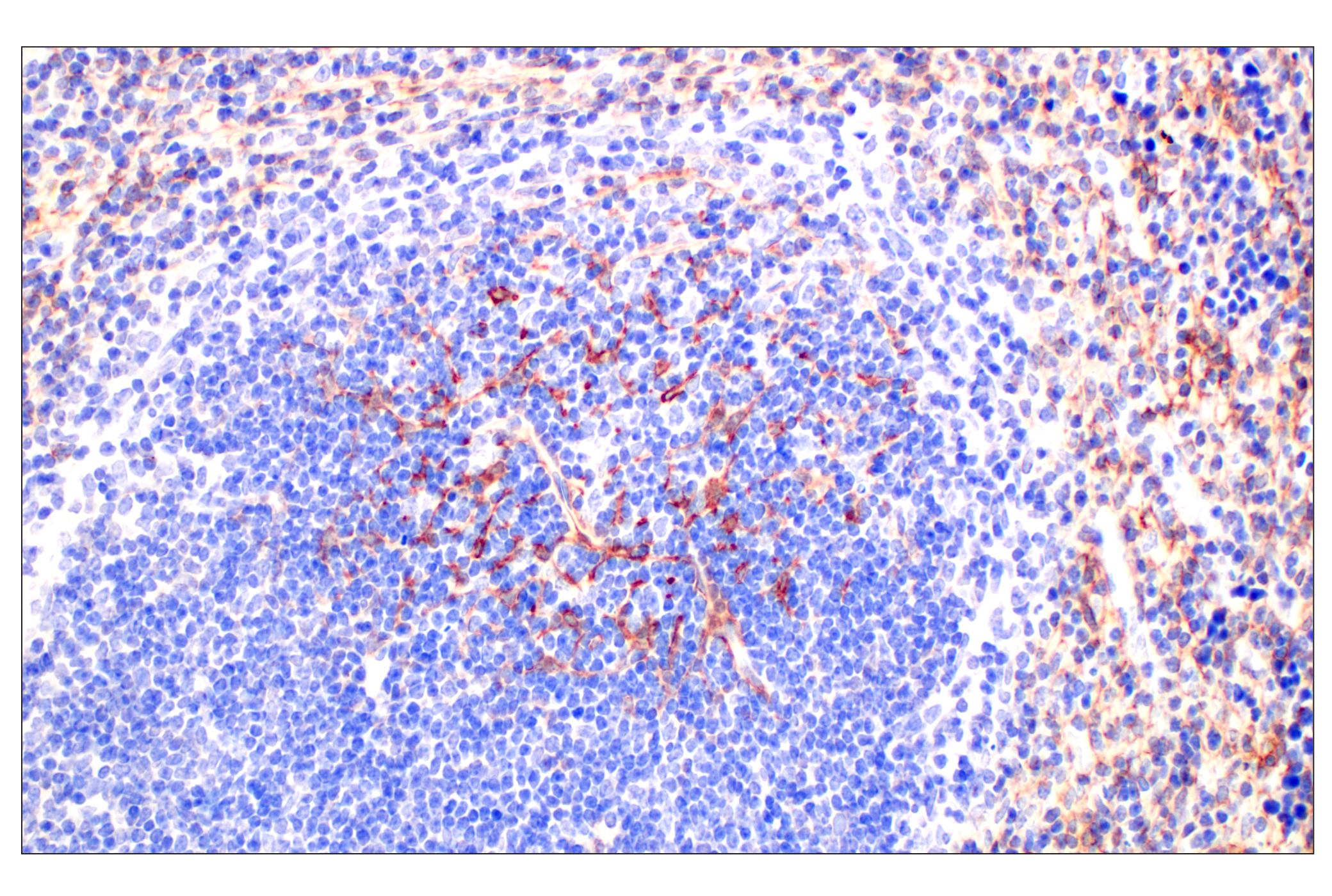 Immunohistochemistry Image 5: CD10/Neprilysin (F4P6H) Rabbit mAb