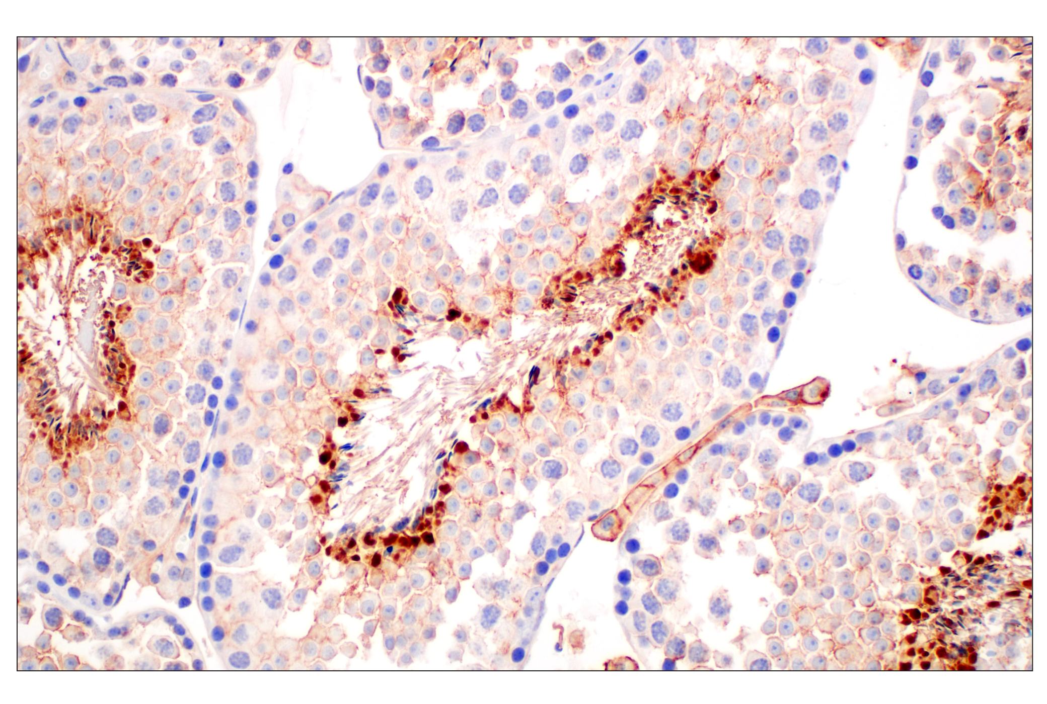 Immunohistochemistry Image 4: CD10/Neprilysin (F4P6H) Rabbit mAb