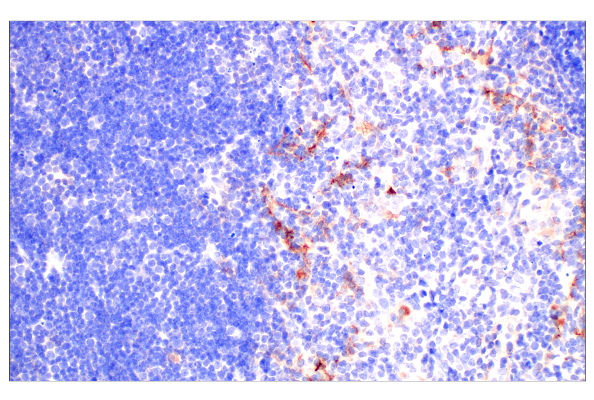 Immunohistochemistry Image 7: CD10/Neprilysin (F4P6H) Rabbit mAb