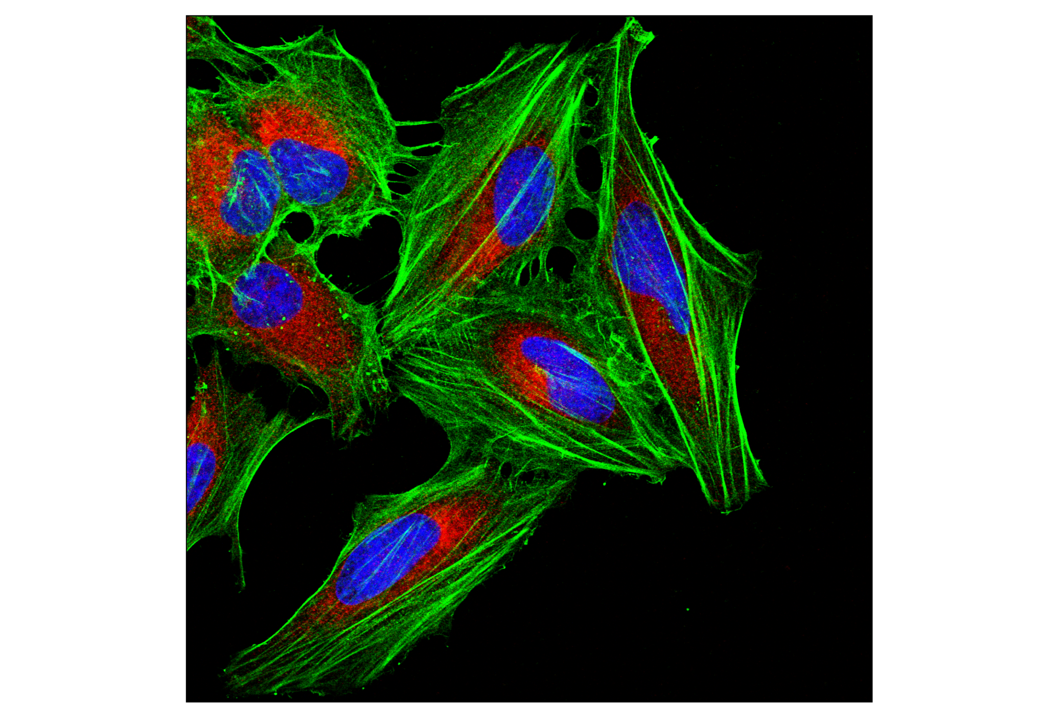Immunofluorescence Image 1: β-Actin (E4D9Z) Mouse mAb