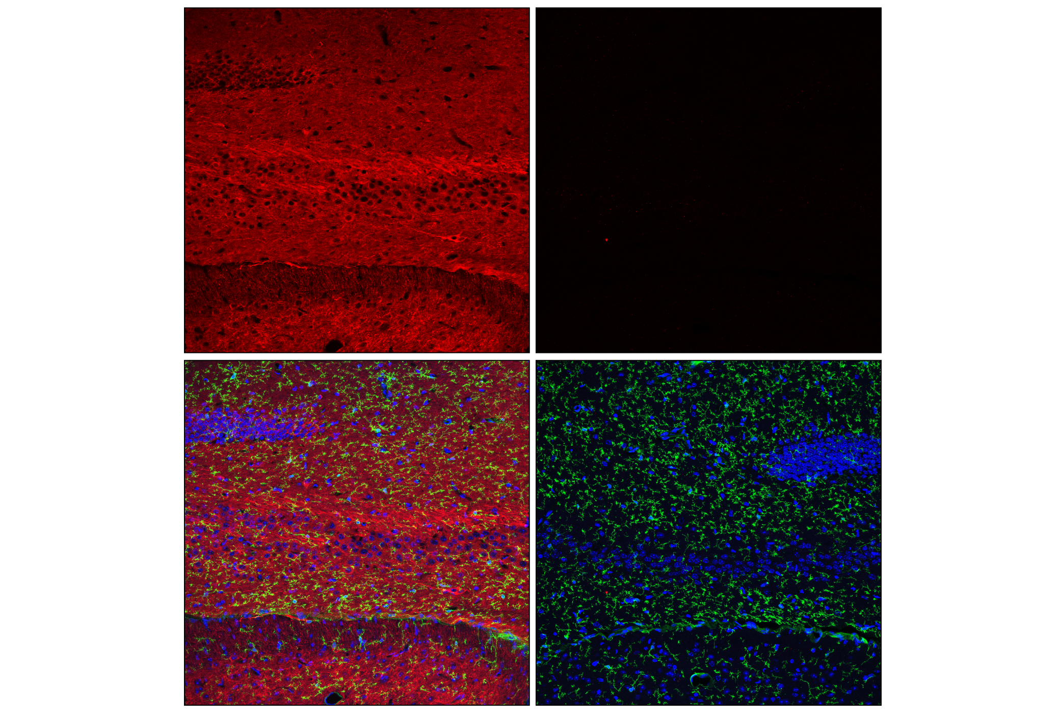 Immunofluorescence Image 1: Tau (E5G6B) Rabbit mAb