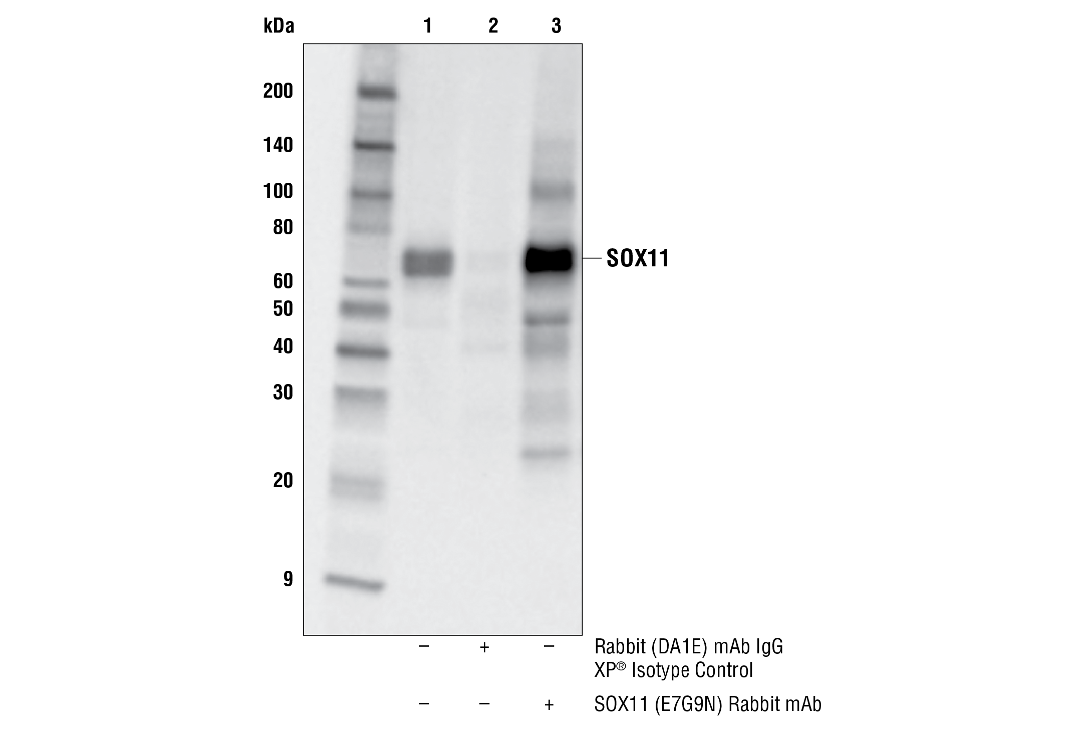 Immunoprecipitation Image 1: SOX11 (E7G9N) Rabbit mAb