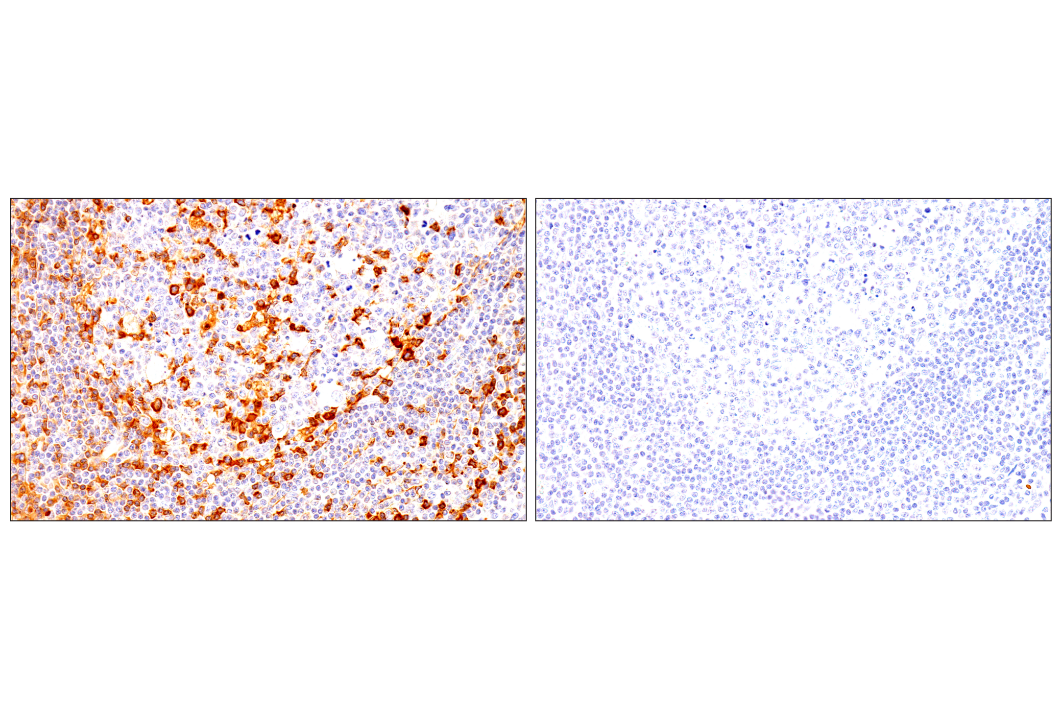 Immunohistochemistry Image 9: CD62L/L-Selectin (E7X9I) Rabbit mAb