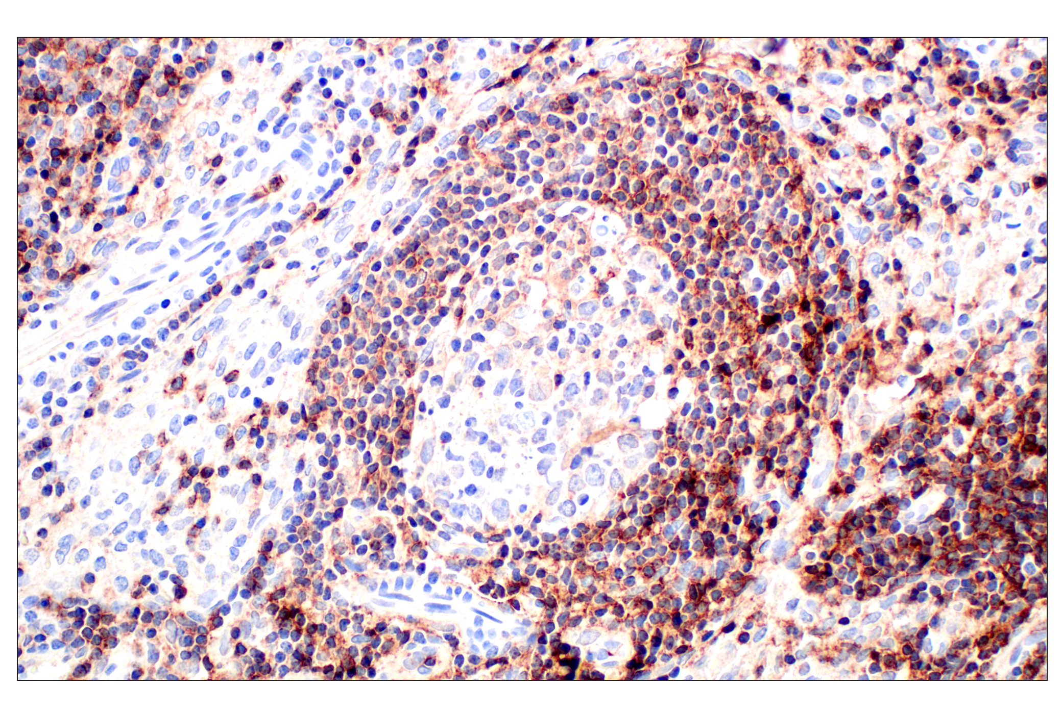 Immunohistochemistry Image 7: CD62L/L-Selectin (E7X9I) Rabbit mAb