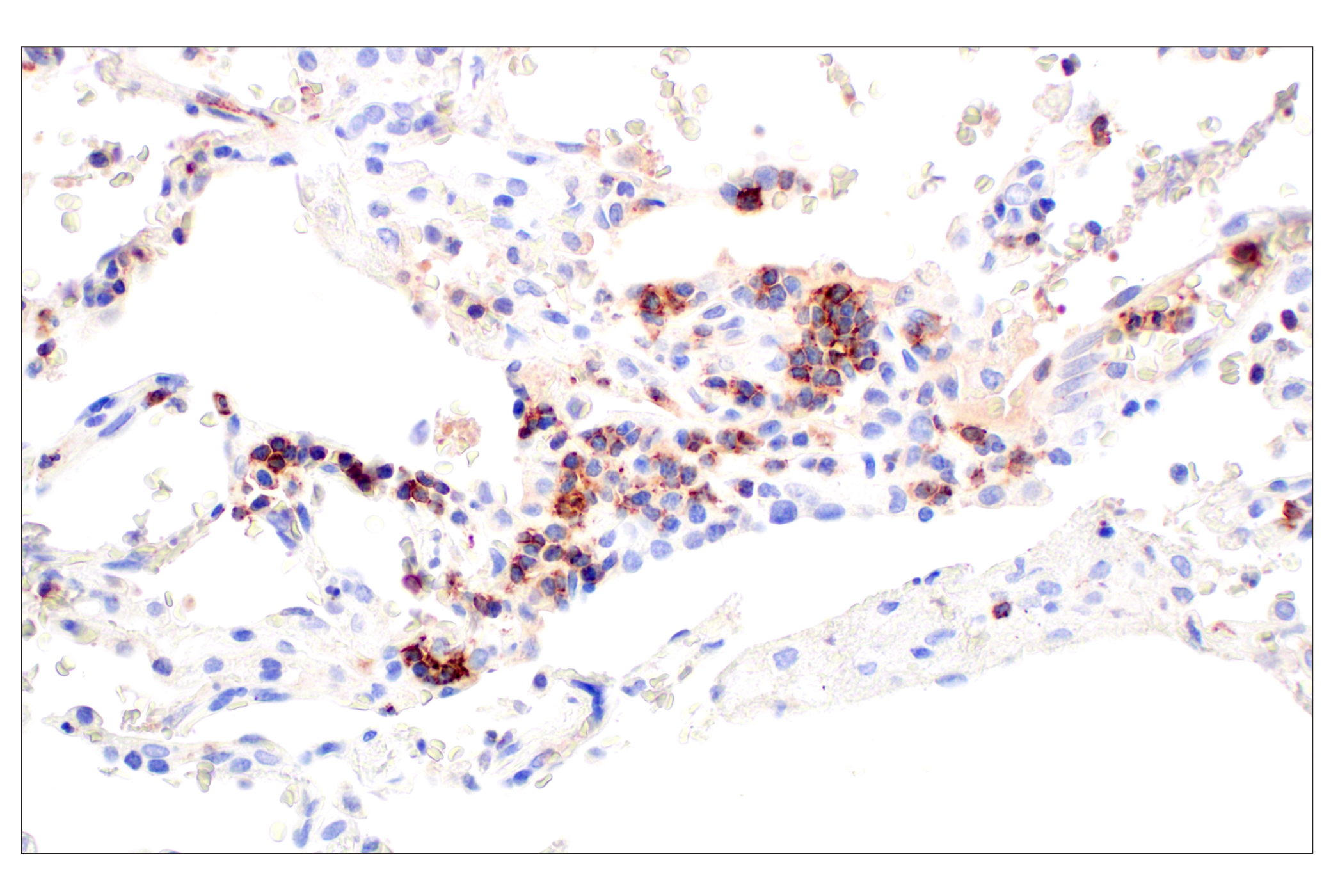 Immunohistochemistry Image 2: CD62L/L-Selectin (E7X9I) Rabbit mAb