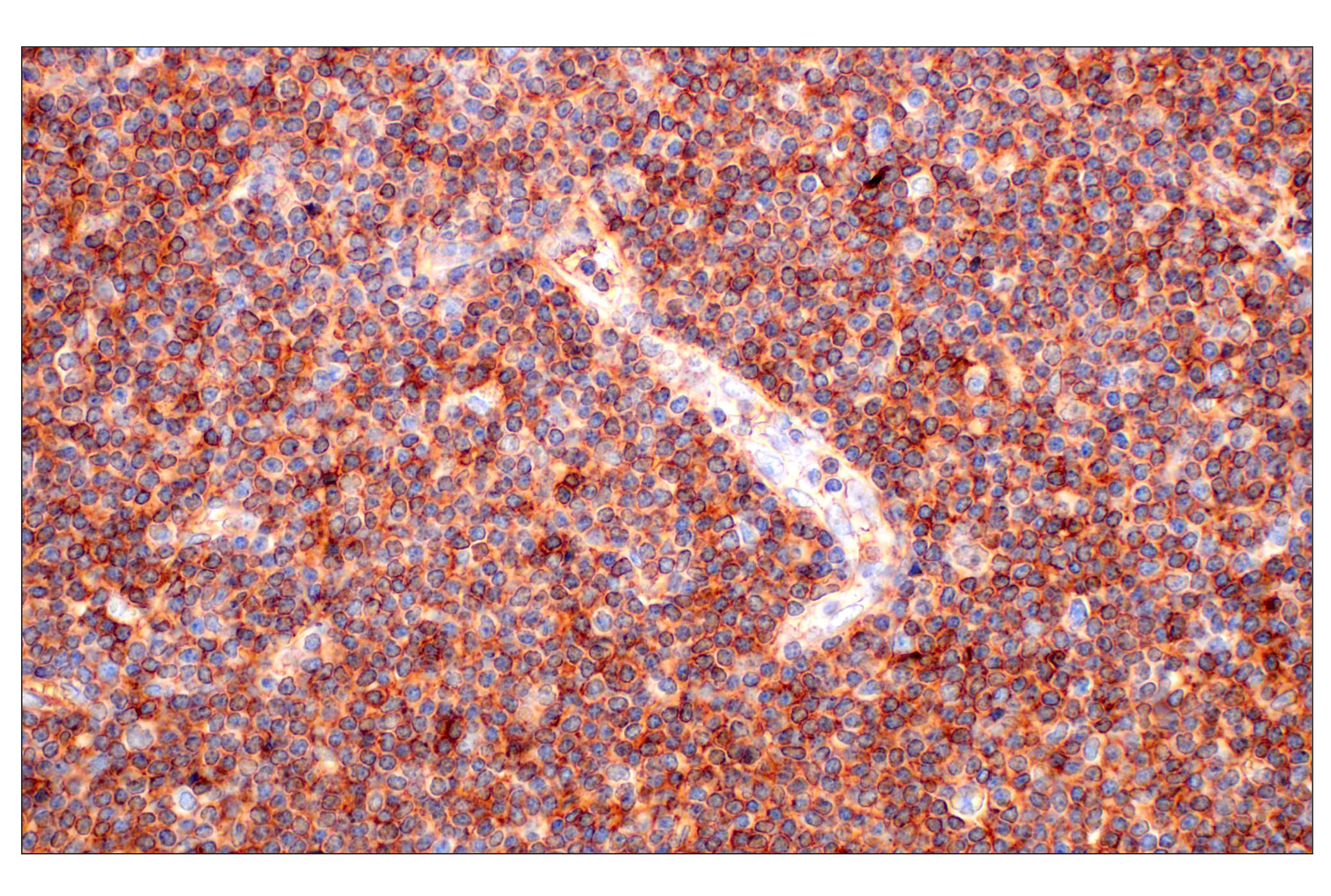Immunohistochemistry Image 1: CD62L/L-Selectin (E7X9I) Rabbit mAb
