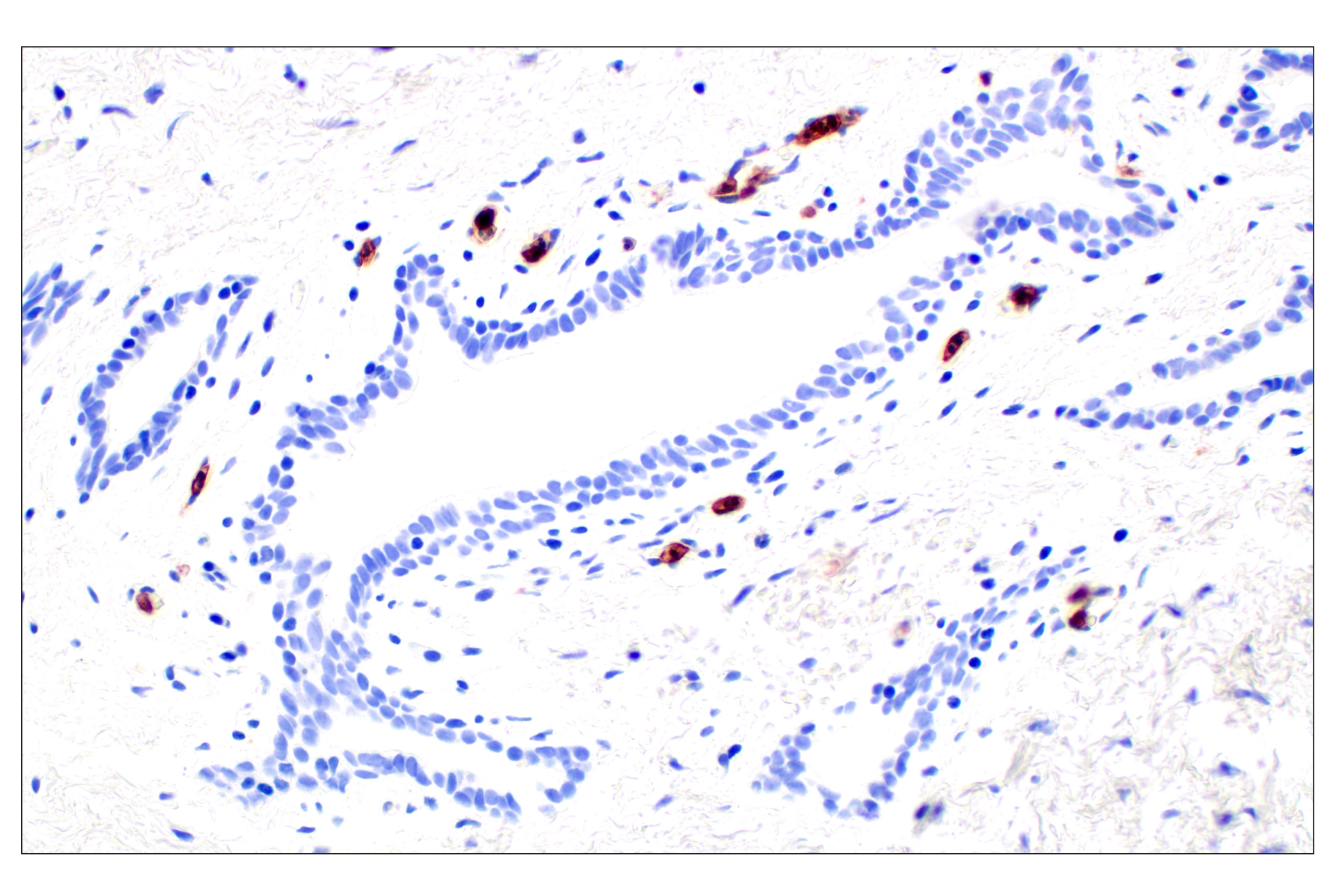 Immunohistochemistry Image 4: CD62L/L-Selectin (E7X9I) Rabbit mAb