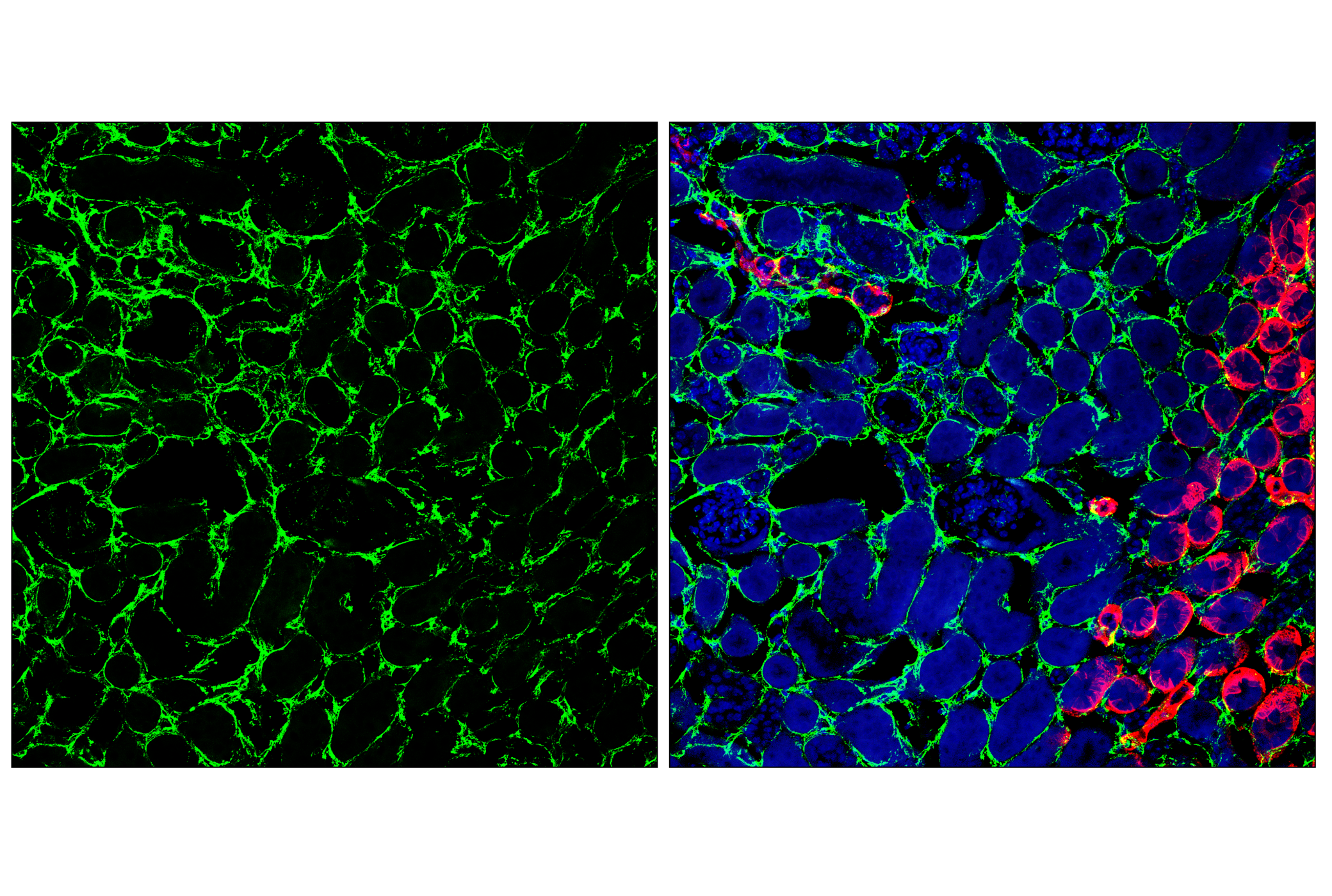 Immunofluorescence Image 3: COL6A1 (E9Q3P) Rabbit mAb