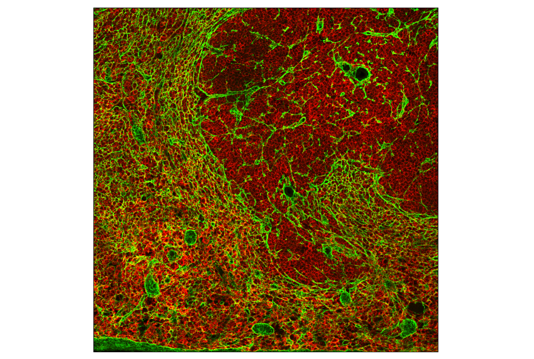 Immunofluorescence Image 1: COL6A1 (E9Q3P) Rabbit mAb