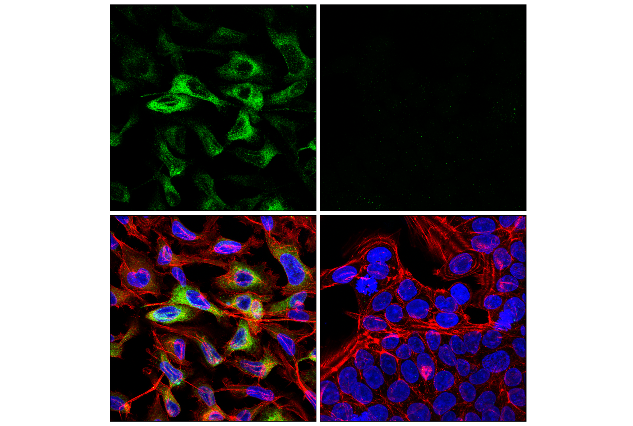 Immunofluorescence Image 4: COL6A1 (E9Q3P) Rabbit mAb