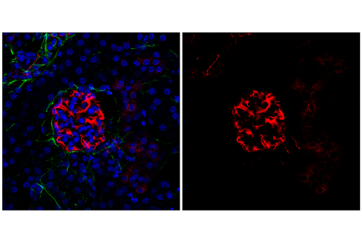 Immunofluorescence Image 2: Acetyl-α-Tubulin (Lys40) (D20G3) XP® Rabbit mAb (Alexa Fluor® 555 Conjugate)