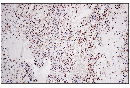 Immunohistochemistry Image 3: DNA-PKcs (E6U3A) Rabbit mAb (BSA and Azide Free)