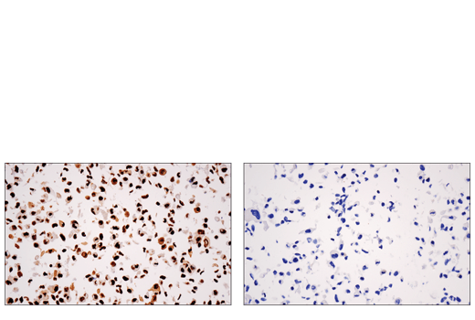 Immunohistochemistry Image 6: DNA-PKcs (E6U3A) Rabbit mAb (BSA and Azide Free)