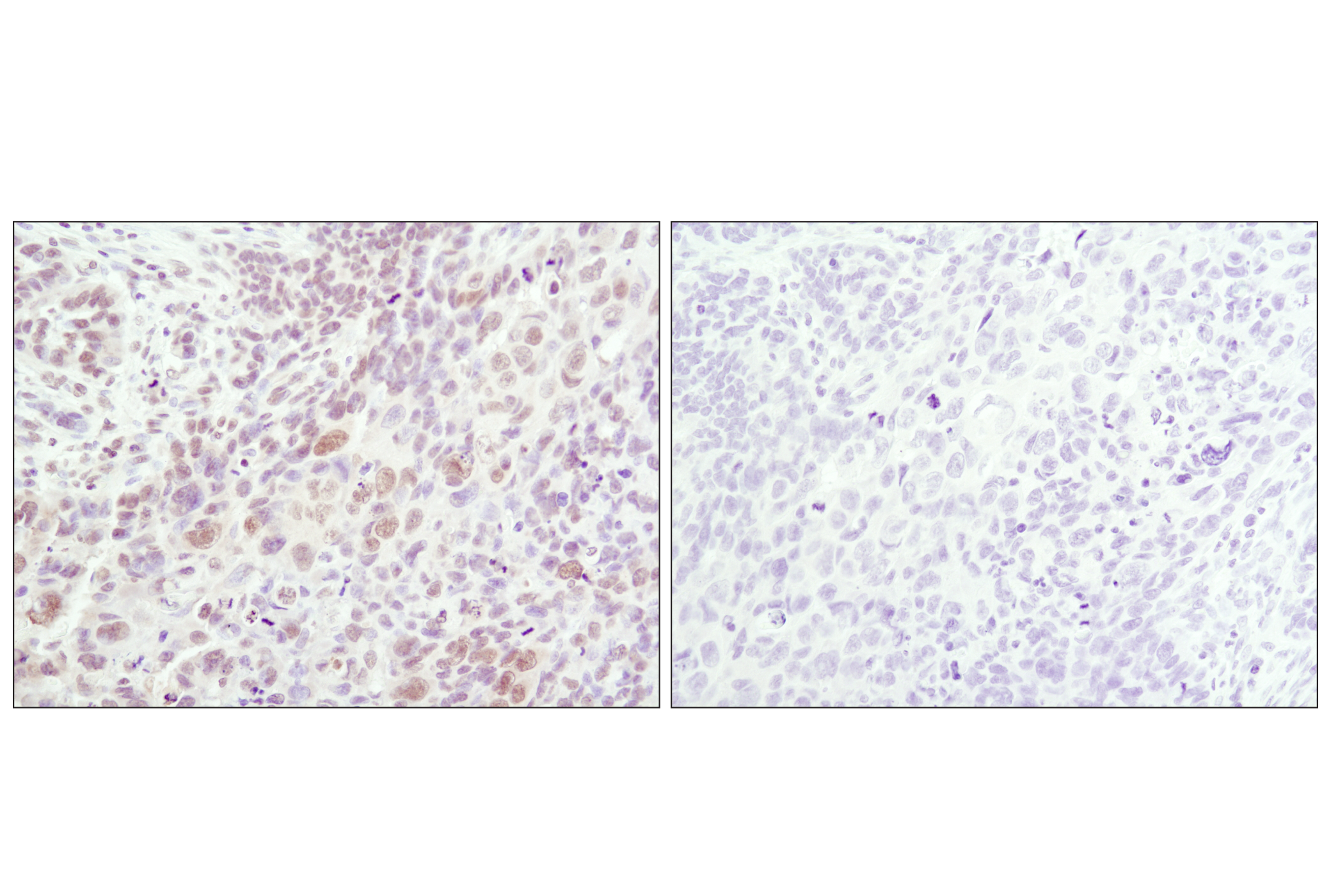 Immunohistochemistry Image 2: Phospho-SAPK/JNK (Thr183/Tyr185) (81E11) Rabbit mAb (BSA and Azide Free)