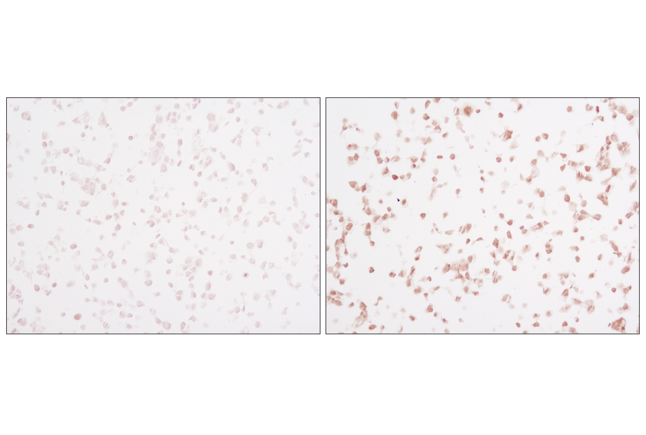 Immunohistochemistry Image 1: Phospho-SAPK/JNK (Thr183/Tyr185) (81E11) Rabbit mAb (BSA and Azide Free)