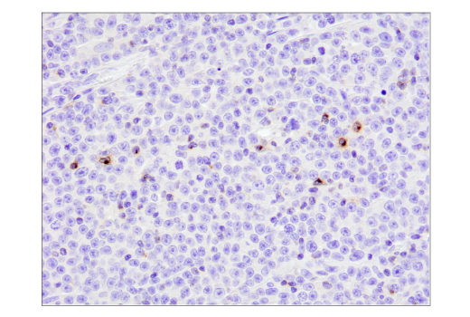 Immunohistochemistry Image 1: 4-1BB/CD137/TNFRSF9 (D2Z4Y) Rabbit mAb (BSA and Azide Free)